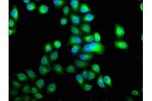 Immunofluorescence staining of Hela cells with ABIN7146412 at 1:100, counter-stained with DAPI. (PDE1A anticorps  (AA 1-219))