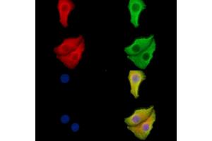 ABIN6265333 and ABIN6278532 staining Hela cells by IF/ICC. (STEAP1 anticorps  (N-Term))