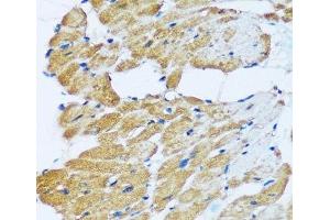Immunohistochemistry of paraffin-embedded Rat heart using ARHGEF5 Polyclonal Antibody at dilution of 1:100 (40x lens). (ARHGEF5 anticorps)