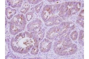 Image no. 2 for anti-Protein Phosphatase 3, Regulatory Subunit B, alpha (PPP3R1) (AA 1-154) antibody (ABIN1500385)