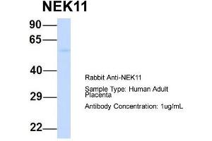 Host:  Rabbit  Target Name:  NEK11  Sample Type:  Human Adult Placenta  Antibody Dilution:  1.