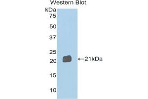 Western blot analysis of the recombinant protein. (SEMA4B anticorps  (AA 192-367))