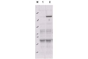 Image no. 1 for anti-rho-Associated, Coiled-Coil Containing Protein Kinase 2 (ROCK2) (pTyr256) antibody (ABIN401393) (ROCK2 anticorps  (pTyr256))