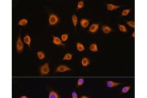 Immunofluorescence analysis of L929 cells using SLC20A1 Polyclonal Antibody at dilution of 1:100. (SLC20A1 anticorps)