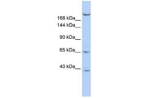KIF13B antibody used at 1 ug/ml to detect target protein. (KIF13B anticorps  (N-Term))