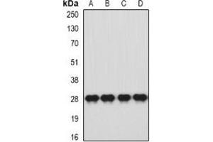Western blot analysis of HLA-DQA1 expression in SW620 (A), HT29 (B), mouse brain (C), mouse stomach (D) whole cell lysates. (HLA-DQA1 anticorps)