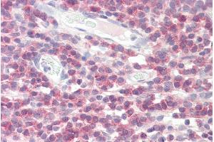 anti-Dolichyl-Phosphate Mannosyltransferase Polypeptide 1, Catalytic Subunit (DPM1) (N-Term) antibody