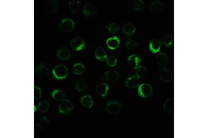 IHC analysis of CIAS1/NALP3 using anti-CIAS1/NALP3 antibody .