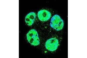 Confocal immunofluorescent analysis of METTL2 Antibody (C-term)(Cat#AP52675PU-N) with ZR-75-1 cell followed by Alexa Fluor 488-conjugated goat anti-rabbit lgG (green).