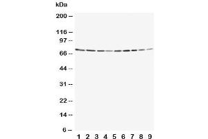 Western blot testing of Annexin VI antibody and Lane 1:  rat ovary (ANXA6 anticorps  (C-Term))