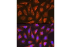 Immunofluorescence analysis of U-2 OS cells using SOCS2 Rabbit mAb (ABIN7270641) at dilution of 1:100 (40x lens).