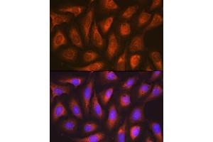 Immunofluorescence analysis of U-2 OS cells using SOCS2 Rabbit mAb (ABIN7270641) at dilution of 1:100 (40x lens). (SOCS2 anticorps)