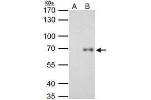 IP Image RelB antibody immunoprecipitates RelB protein in IP experiments.