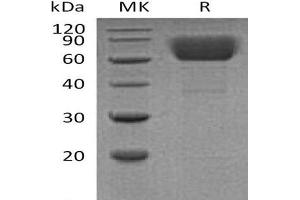 Western Blotting (WB) image for Ectonucleoside Triphosphate diphosphohydrolase 1 (ENTPD1) protein (His tag) (ABIN7320837)
