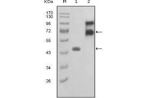 Western blot analysis using FBLN2 mouse mAb against truncated FBLN2-Trx recombinant protein (1) and truncated FBLN2 (aa28-444)-hIgGFc transfected COS7 cell lysate(2). (FBLN2 anticorps  (AA 180-440))