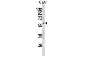 Western blot analysis of FLCN Antibody (Center) in CEM cell line lysates (35ug/lane).