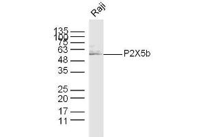 Raji (hu) lysates probed with P2X5b Polyclonal Antibody, unconjugated  at 1:300 overnight at 4°C followed by a conjugated secondary antibody at 1:10000 for 60 minutes at 37°C. (P2X5b (AA 261-360) anticorps)