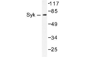 Image no. 1 for anti-Spleen tyrosine Kinase (SYK) antibody (ABIN271834) (SYK anticorps)