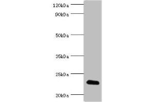 Western blot All lanes: FGF6 antibody at 10 μg/mL + HepG2 whole cell lysate Secondary Goat polyclonal to rabbit IgG at 1/10000 dilution Predicted band size: 23 kDa Observed band size: 23 kDa (FGF6 anticorps  (AA 38-208))