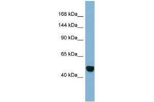 Host:  Rabbit  Target Name:  MAML3  Sample Type:  Fetal Stomach lysates  Antibody Dilution:  1. (MAML3 anticorps  (C-Term))