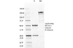 SDS-PAGE Analysis Purified Cytokeratin 14 Mouse Monoclonal Antibody (LL002). (KRT14 anticorps  (C-Term))
