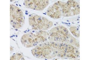 Immunohistochemistry of paraffin-embedded Human stomach using MTERFD3 Polyclonal Antibody at dilution of 1:100 (40x lens).