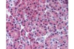 Receptor-interacting serine-threonine kinase 3 Immunohistochemistry.