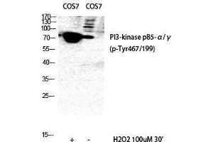 Western Blotting (WB) image for anti-Phosphoinositide 3 Kinase, p85/p55 (PI3K p85/p55) (pTyr199), (pTyr467) antibody (ABIN3182123) (PI3K p85/p55 anticorps  (pTyr199, pTyr467))