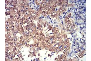 Immunohistochemistry (IHC) image for anti-PR Domain Containing 4 (PRDM4) (AA 476-575) antibody (ABIN5874480) (PRDM4 anticorps  (AA 476-575))