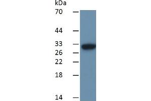 Mouse Capture antibody from the kit in WB with Positive Control: Sample Human Jurkat cell lysate.