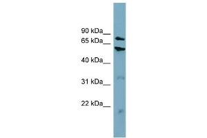 WB Suggested Anti-CPT1B  Antibody Titration: 0. (CPT1B anticorps  (Middle Region))