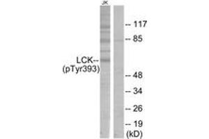 Western blot analysis of extracts from Jurkat cells, using Lck (Phospho-Tyr393) Antibody. (LCK anticorps  (pTyr394))