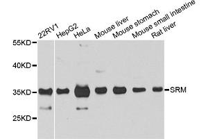 Western blot analysis of extracts of various cell lines, using SRM antibody. (Spermidine Synthase anticorps)