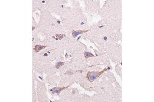 D staining Nestin in human brain tissue sections by Immunohistochemistry (IHC-P - paraformaldehyde-fixed, paraffin-embedded sections). (Nestin anticorps  (AA 1389-1416))