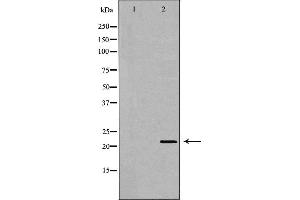Western blot analysis of Hepg2 whole cell lysates, using NUDT1 Antibody.