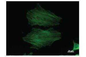 Immunostaining analysis in HeLa cells.