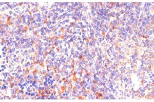 Immunohistochemistry of paraffin-embedded Mouse spleen using ROCK1 Polyclonal Antibody at dilution of 1:100 (40x lens). (ROCK1 anticorps)
