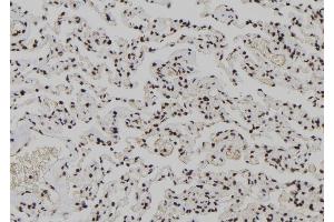 ABIN6278212 at 1/100 staining Human lung tissue by IHC-P. (XPO4 anticorps  (N-Term))