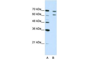 Western Blotting (WB) image for anti-Cleavage and Polyadenylation Specific Factor 3, 73kDa (CPSF3) antibody (ABIN2462266) (CPSF3 anticorps)
