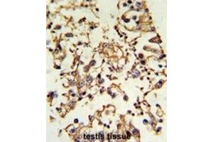 Immunohistochemistry (IHC) image for anti-Protein Kinase A, alpha (PRKACA) antibody (ABIN3002818)