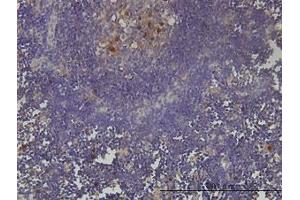 Image no. 1 for anti-PCNA Clamp Associated Factor (PAF) (AA 1-112) antibody (ABIN599096) (KIAA0101 anticorps  (AA 1-112))