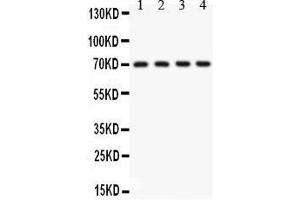 Anti- KCNMA1antibody, Western blotting All lanes: Anti KCNMA1  at 0. (KCNMA1 anticorps  (AA 124-467))