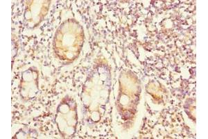 Immunohistochemistry of paraffin-embedded human small intestine tissue using ABIN7152363 at dilution of 1:100 (EYA3 anticorps  (AA 1-300))