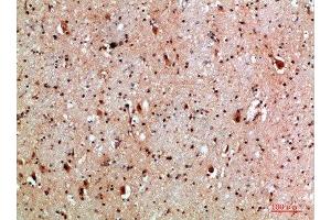 Immunohistochemical analysis of paraffin-embedded human-brain, antibody was diluted at 1:200 (NLRX1 anticorps  (AA 581-630))