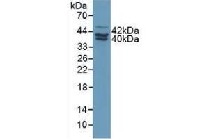 Detection of PAI2 in Human MCF7 Cells using Polyclonal Antibody to Plasminogen Activator Inhibitor 2 (PAI2) (SERPINB2 anticorps  (AA 154-408))
