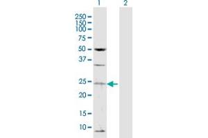 Western Blot analysis of TAF13 expression in transfected 293T cell line by TAF13 MaxPab polyclonal antibody. (TAF13 anticorps  (AA 1-124))