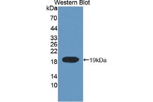 Detection of Recombinant TOP3, Human using Polyclonal Antibody to Topoisomerase III (TOP3) (TOP3 anticorps  (AA 35-179))
