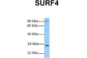 Host:  Rabbit  Target Name:  SURF4  Sample Tissue:  Human Stomach Tumor  Antibody Dilution:  1. (Surfeit 4 anticorps  (N-Term))