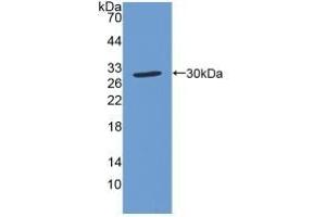 Detection of Recombinant SOD4, Human using Polyclonal Antibody to Superoxide Dismutase Copper Chaperone (Superoxide dismutase copper chaperone anticorps  (AA 23-269))