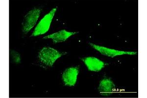 Immunofluorescence of purified MaxPab antibody to FGF5 on HeLa cell. (FGF5 anticorps  (AA 1-123))